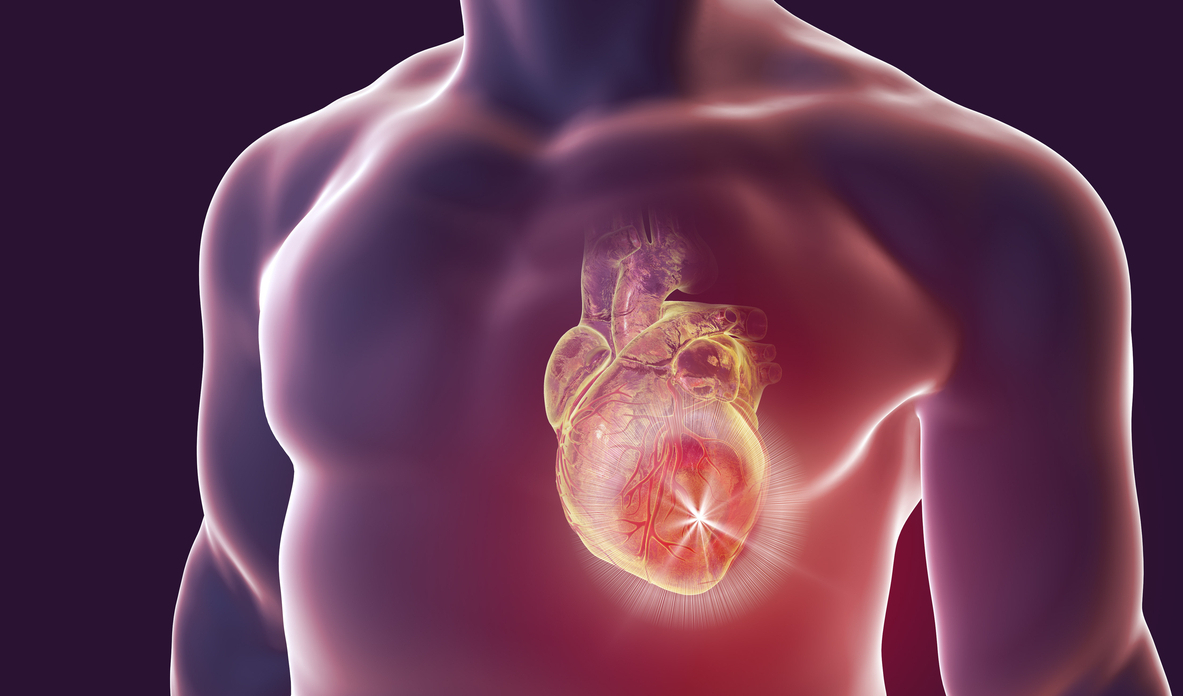 Morning exercise and heart bypass surgery Credo