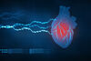 Photo of eyes provides forecast of longevity in heart failure patients
