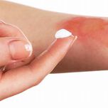 Use of Ceramides and Related Products for Childhood-Onset Eczema
