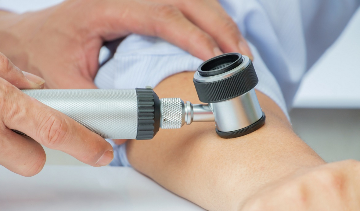 Skin-related side effects of targeted cancer therapies ...