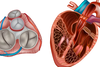 Modern heart valve diagnostics & therapy - VIDEO