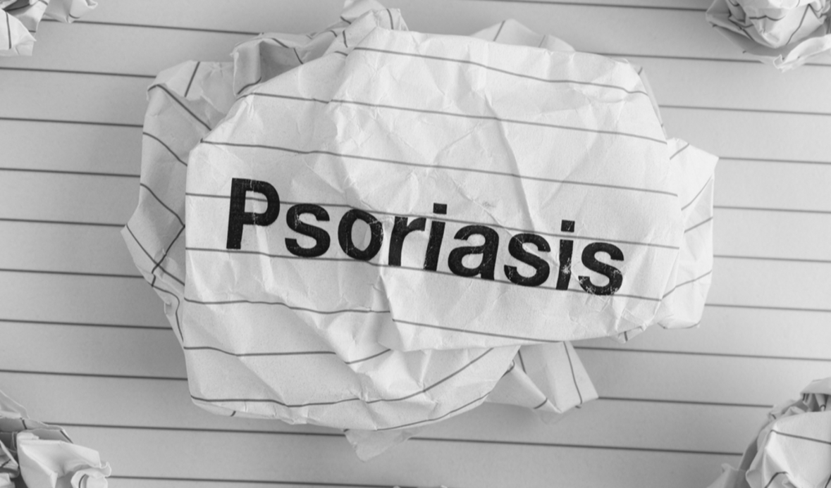 PEDIATRIC PSORIASIS treatment guidelines | CredoWeb