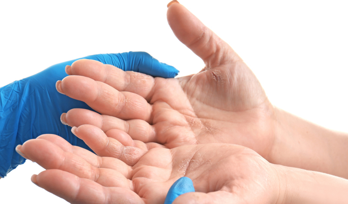 Hair Dyes Damage Hairdressers Skin CredoWeb