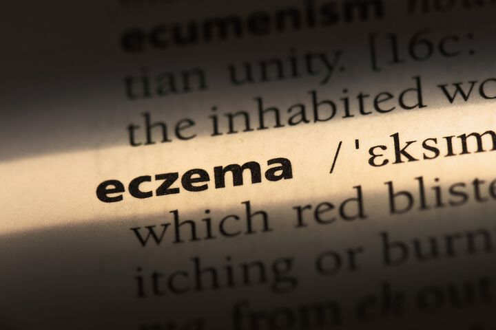 How to treat eczema in babies