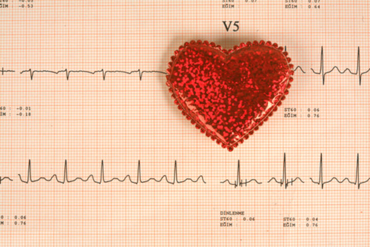 A Rare Occurrence of Focal Atrial Tachycardia in a Patient with Mixed Connective Tissue Disease and Chronic Rheumatic Heart Disease: A Possible Linkage?