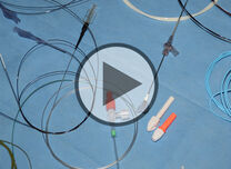 Herzkatheter: Fragen & Antworten - Video