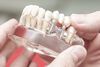 Имплантология и зъбни импланти
