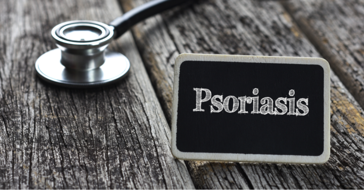 French guidelines on the use of systemic treatments for moderate-to-severe psoriasis in adults