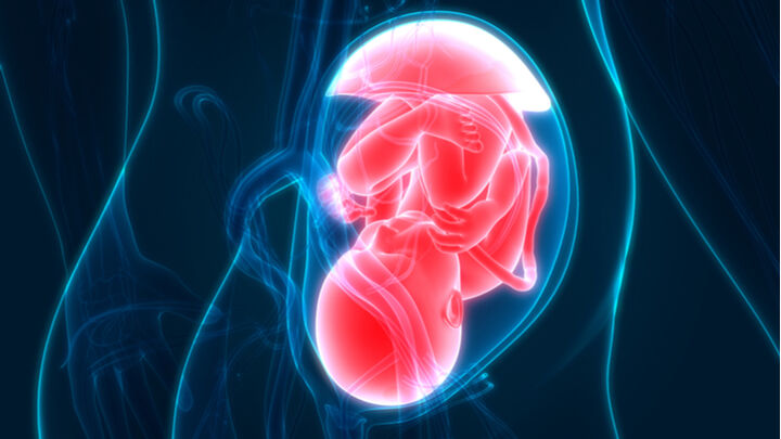 Plaque defects are a critical factor in prenatal development