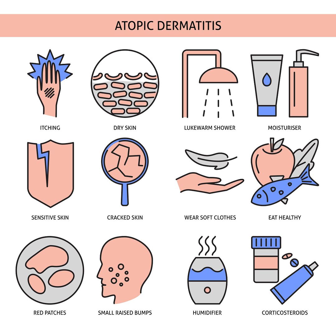 Причини за атопичен дерматит