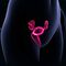 Diagnose: Gebärmutterhalskrebs - Video