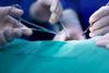 Специалистите от ВМА спасиха живота на 31-годишен мъж чрез сложна трансплантация