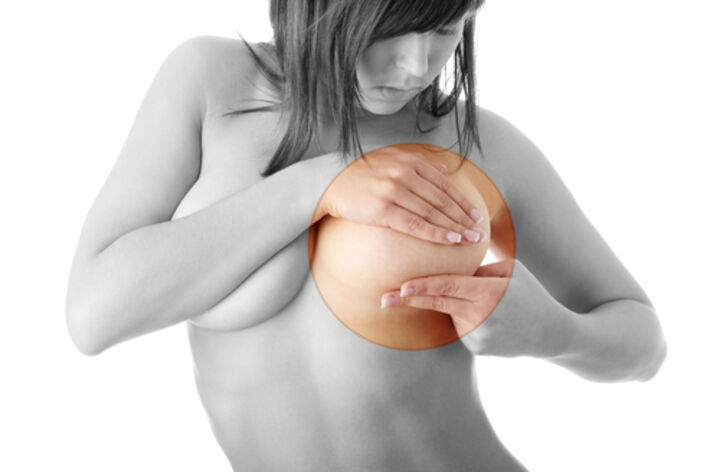 Breast implants linked to cancer taken form the market in EU