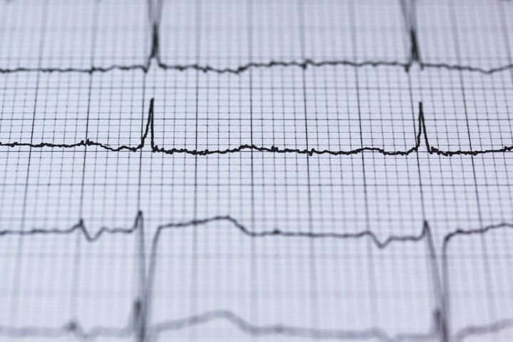 Double Emergency Associating Acute Aortic Dissection and Pulmonary Embolism of Fatal Evolution: About a Case