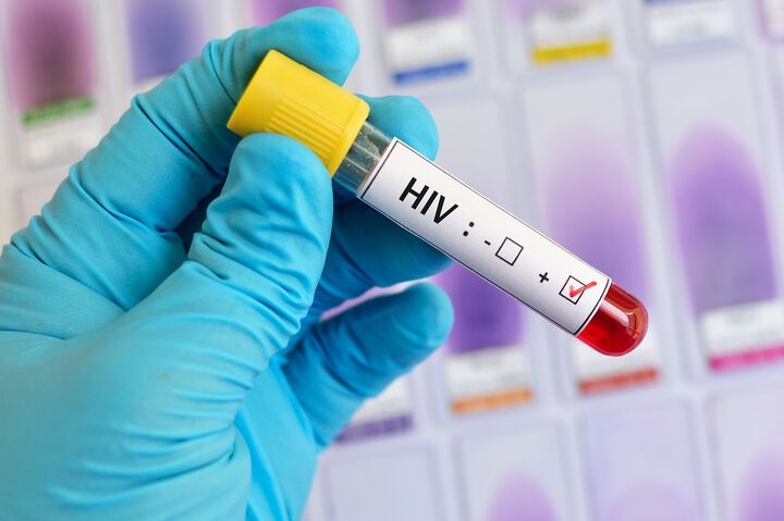 3 127 са носителите на ХИВ в страната