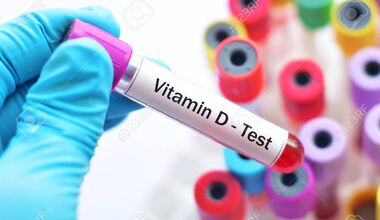 Дискусионна тема: скрининг за хиповитаминоза Д  и  интерпретация на витамин Д статуса