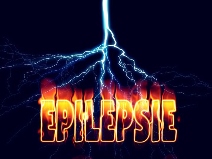 Alles was Sie über EPILEPSIE wissen sollten - Videos