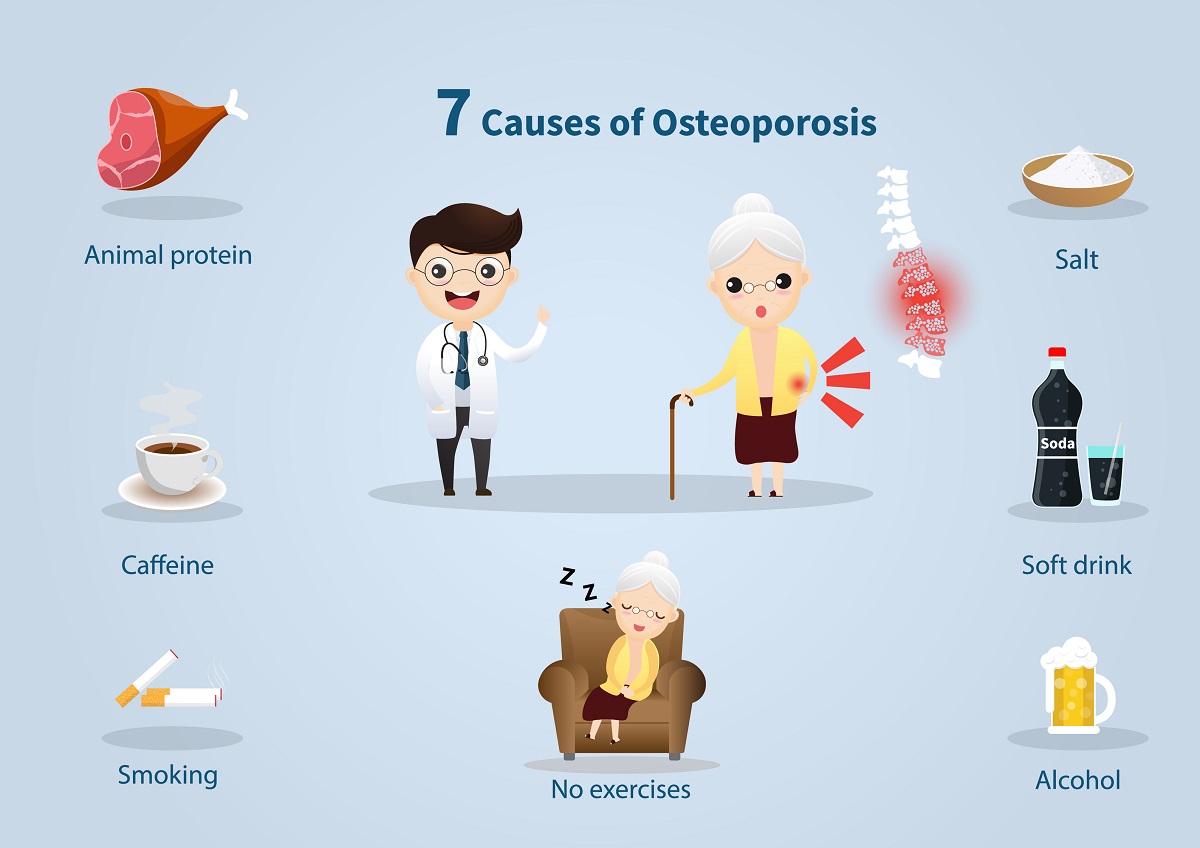 рискови фактори за остеопороза