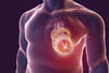 Forscher suchen Marker für Reparaturprozesse nach Herzinfarkt