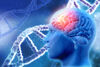 Drei Mutationen treiben die Entwicklung von Glioblastomen