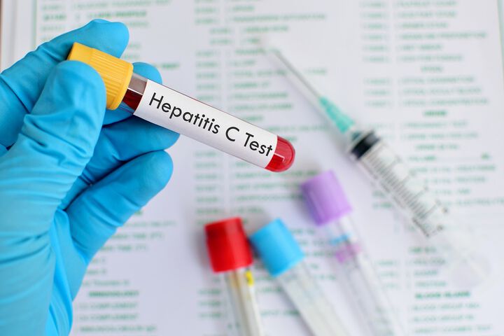Безплатни изследвания за хепатит C 