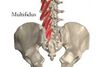 Стабилизиращи мускули на гръбнака и тяхната хипотрофия