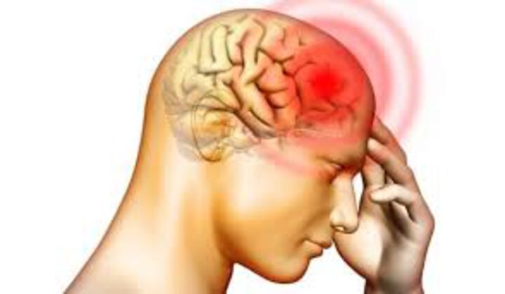 От Клиника по неврология ще отбележат с инициативи 29 октомври - Световен ден за борба с мозъчния инсулт